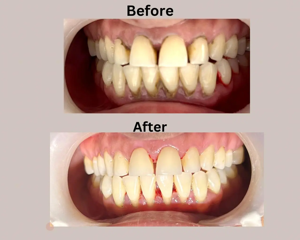Cleaning Image 1