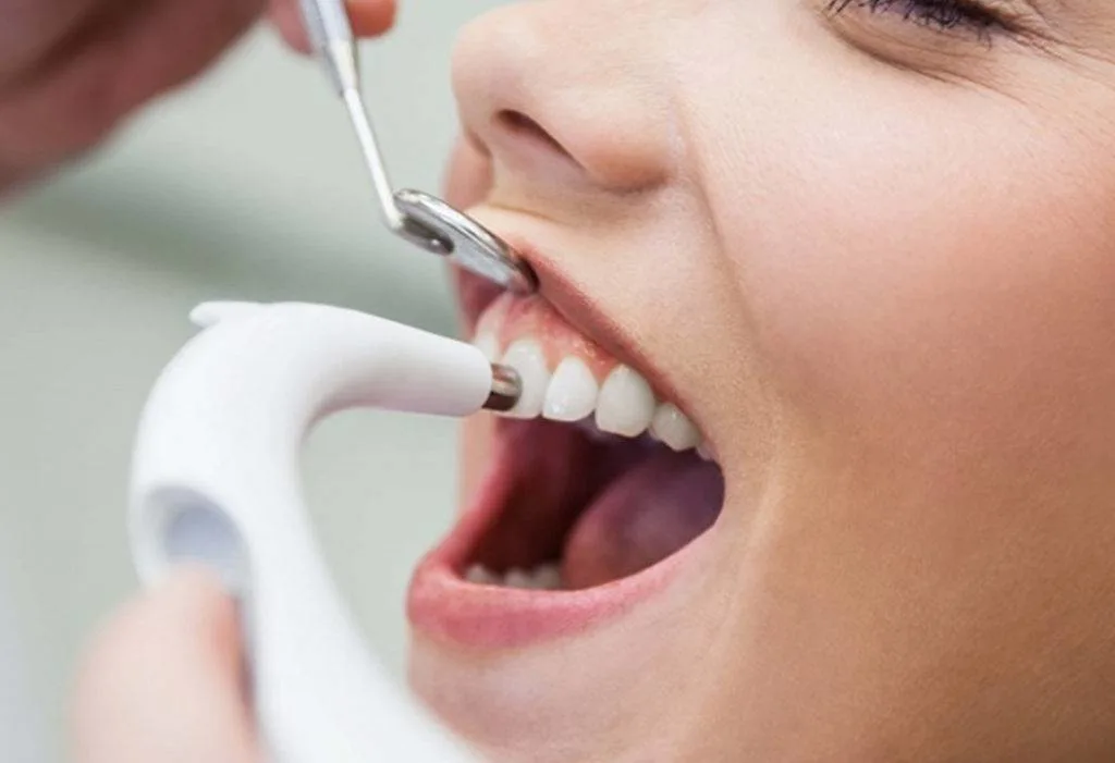Teeth Cleaning Treatment