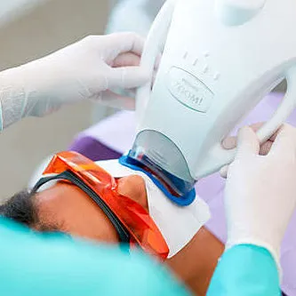 Teeth Whitening treatment for a whiter, brighter smile