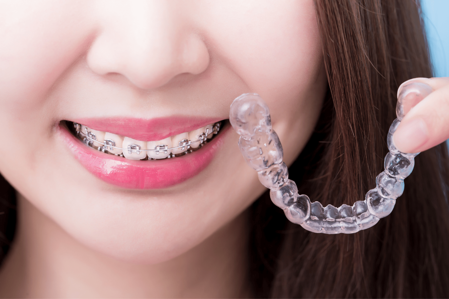 Side-by-side comparison of clear aligners and braces — highlighting who aligners work best for.